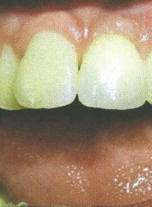 Implantat2.JPG (51300 Byte)