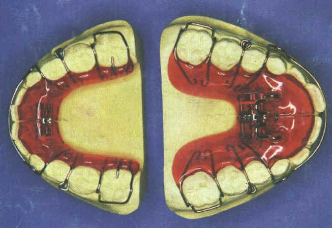 Kieferorthopdie2.JPG (147216 Byte)