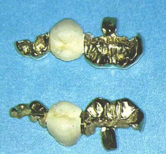inlays.jpg (84847 Byte)